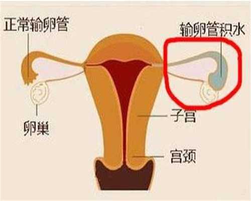 人工授精就是把丈夫或供精者的精液采用工人注