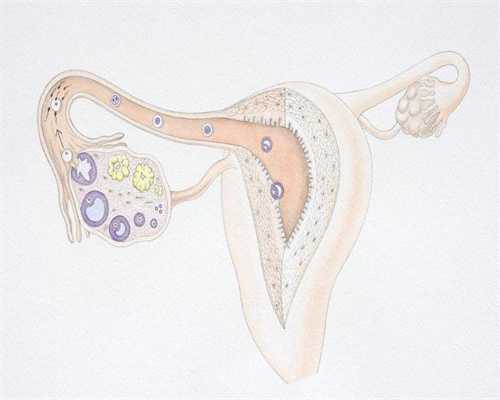卵巢功能衰退能治愈吗：精子形状也是决定代孕