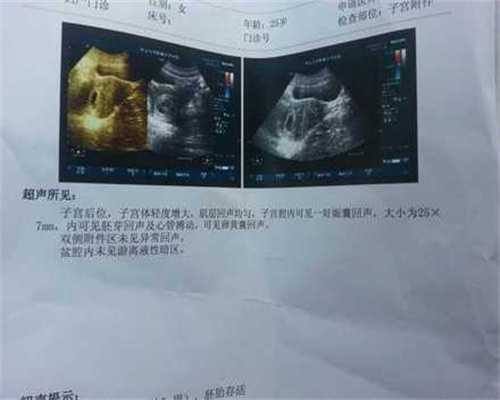 上海那家不孕不育好：生女儿一个月后，我又怀