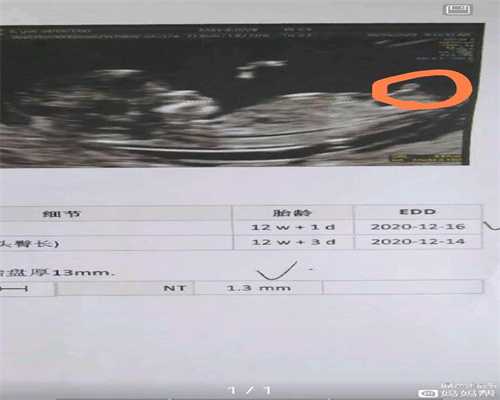 上海代孕多少钱_代怀孕价格多少_代怀孕助孕机构