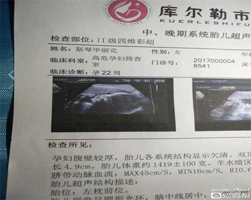 上海代孕公司_代孕费用多少合适_代孕助孕哪里好