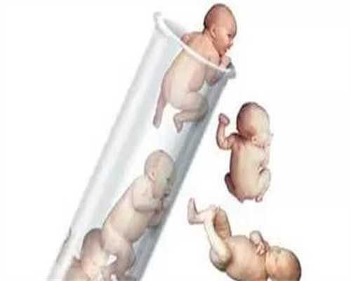 泰国代孕怎么选择性别-找个女人代孕要多少费用_少精症为什么不育